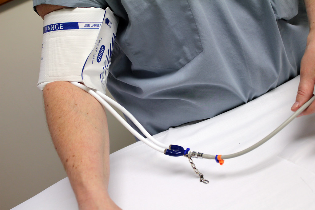 A home blood pressure monitor with an arm cuff attached, showing a reading on the display
